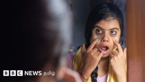 கருவளையம் வருவதற்கான 4 முக்கிய காரணங்கள்: வெள்ளரி வைத்தால் குறையுமா? நிபுணர் பதிலளிக்கும் 13 கேள்விகள்