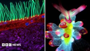 See tiny organisms on show in microscopic video competition